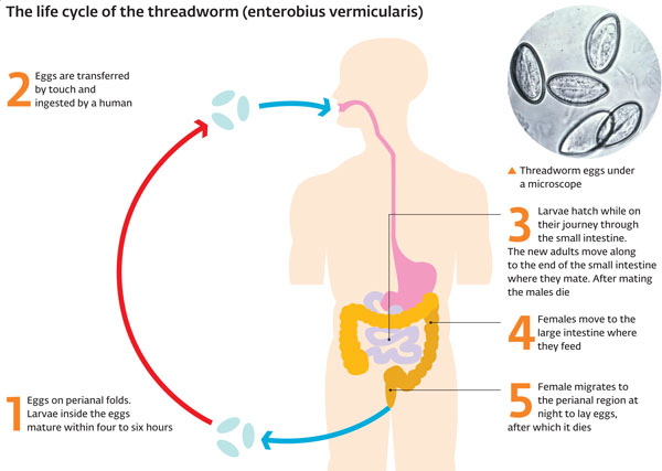Enterobius vermicularis treatment nhs