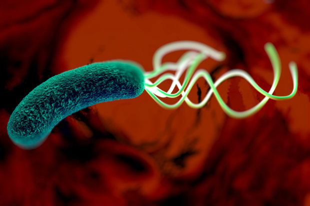 H pylori infection