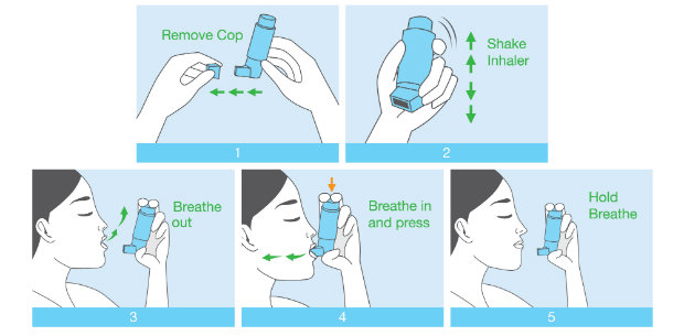 MUR case study: Is this 60 year old using his inhaler too often ...