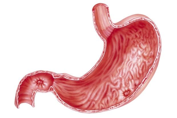 Ulcers in the stomach and duodenum (duodenal ulcer) may be described as a ‘peptic ulcer’ Ulcers in the stomach and duodenum (duodenal ulcer) may be described as a ‘peptic ulcer’