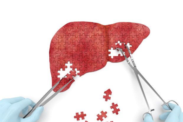 liver disease CPD Liver disease CPD